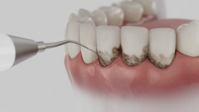 Reliable Dental Implants contractor in Milan, OH by Smile Center Dentistry